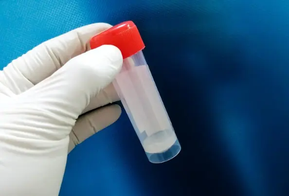 La azoospermia