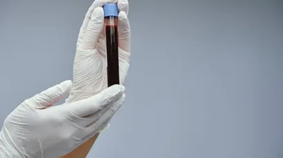 analisis de sangre