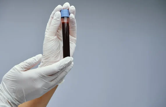 analisis de sangre