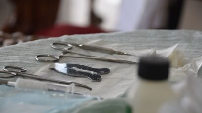 Operacion de la circunsicion