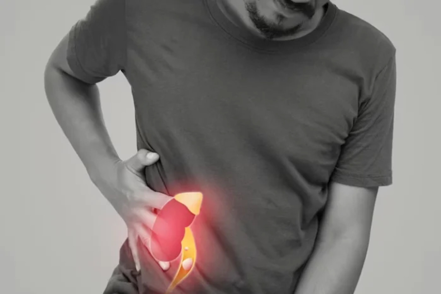 Glomerulonefritis