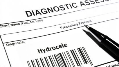 Hidrocele en adultos