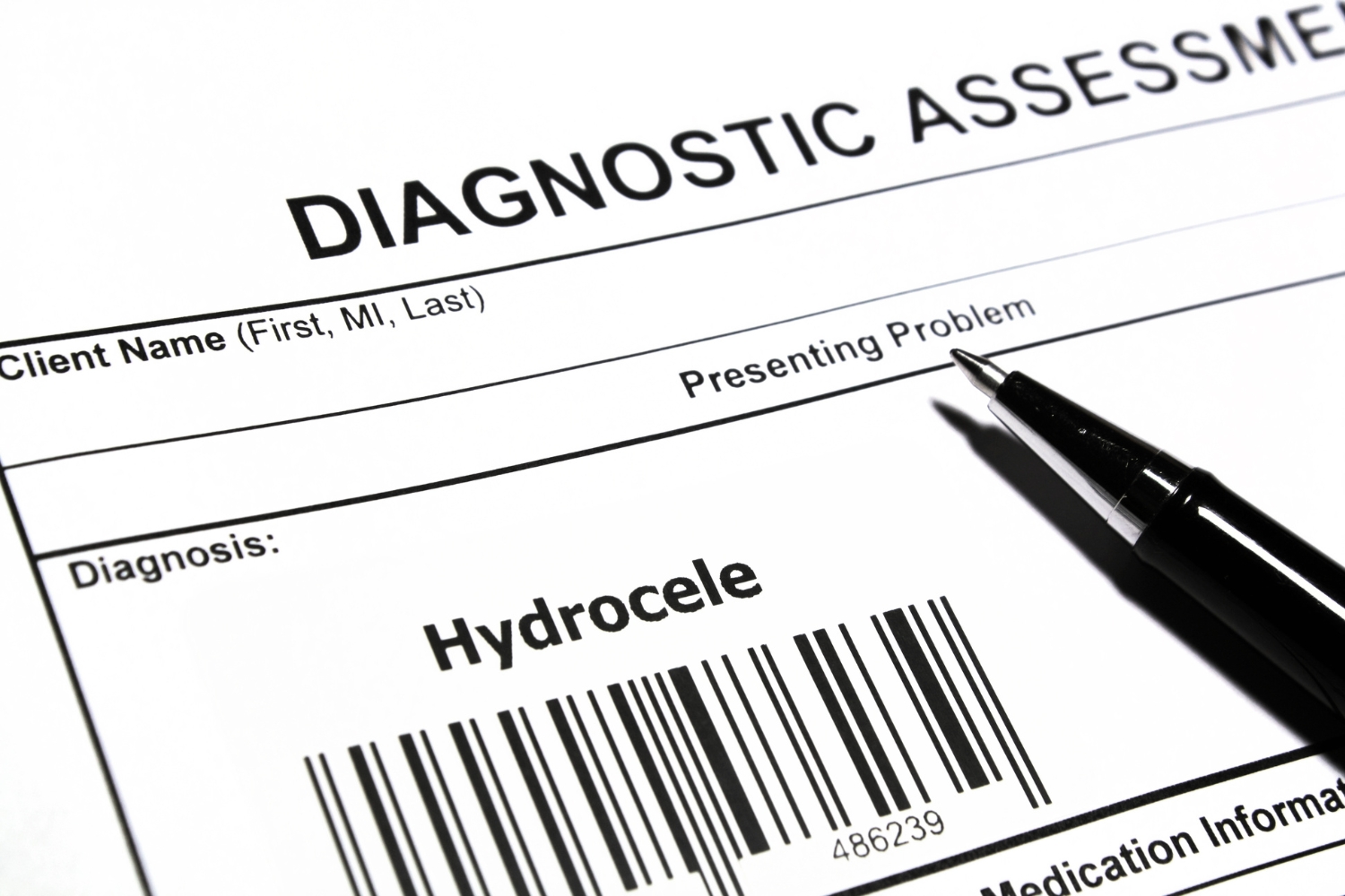 Hidrocele en adultos