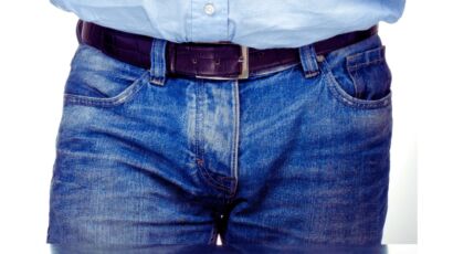 tratamiento para la fimosis