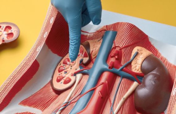 cómo saber si tengo piedras en los riñones CUC