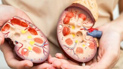 expulsar piedras del riñón naturalmente (503 x 323 px)