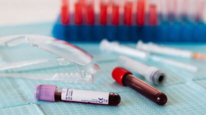 Antígeno Prostático Específico Total