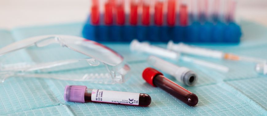 Antígeno Prostático Específico Total