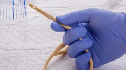 Cuidados del Cateter Doble J