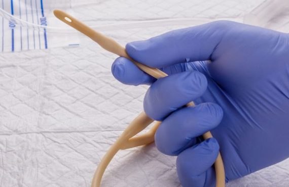 Cuidados del Cateter Doble J