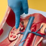 Ureteropielocaliectasia: entenderla a tiempo