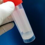 Espermograma: la prueba clave para evaluar la fertilidad